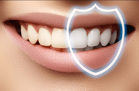 Is Zoom Whitening Safe for My Teeth and Gums?